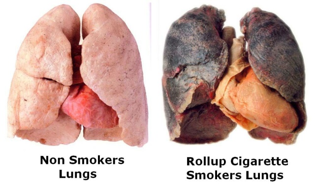 吸菸的肺